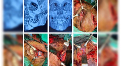 Maxillofacial Trauma & Fracture Management illustration